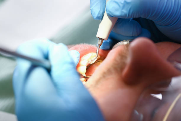 Best After-Hours Emergency Dentist in West St Paul, MN